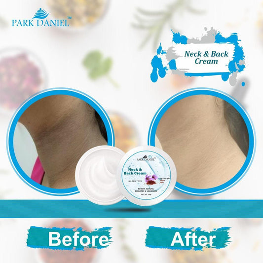 Park Daniel Neck and Back Whitening Cream - Dead Skin Cells Repair | Tan Removal Pack (100 grams)